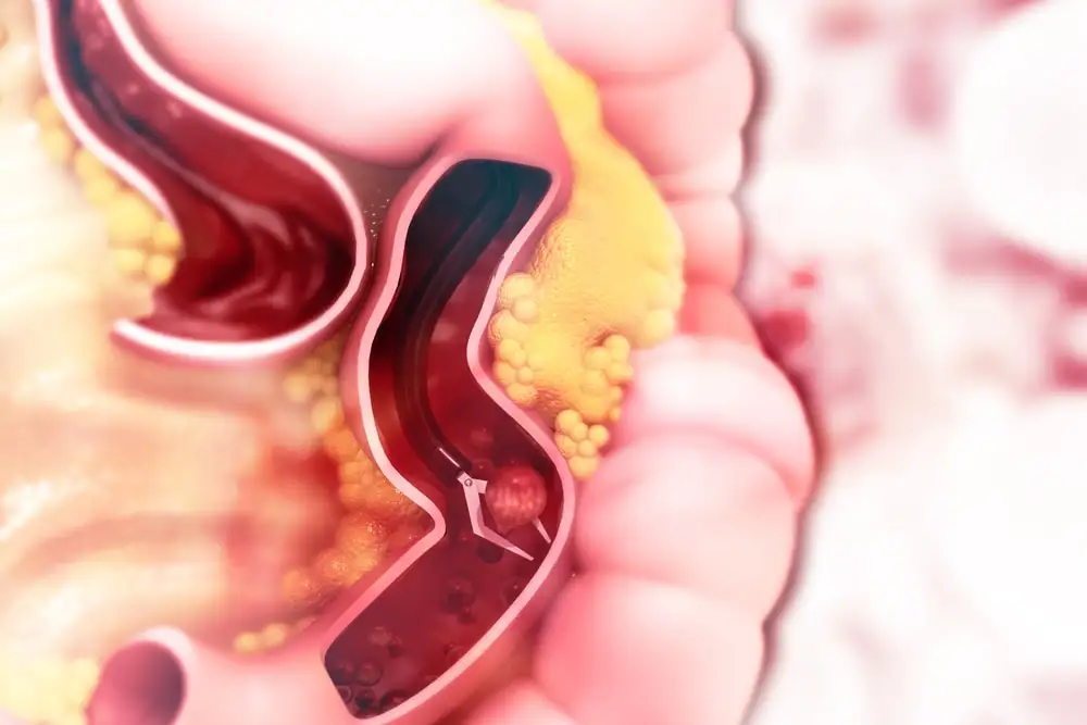 Efectos al pasar el cursor sobre la imagen