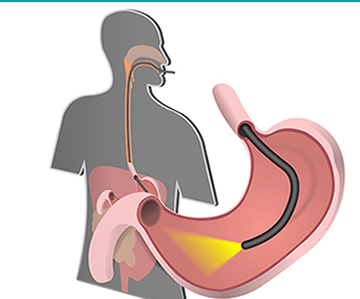 Efectos al pasar el cursor sobre la imagen